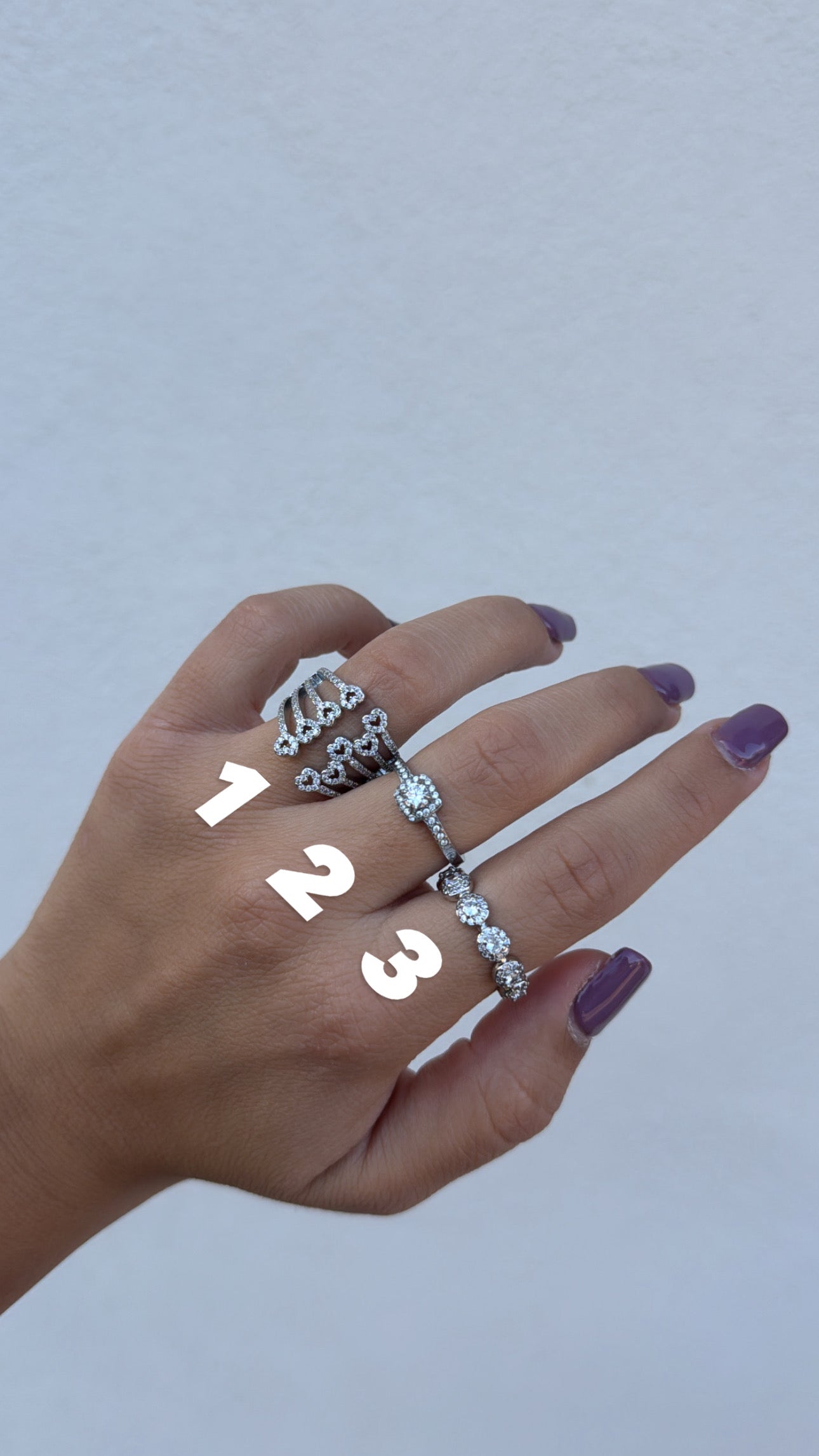 Anello ludo
